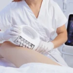 Inner Roller - Lymphatic Dranaige