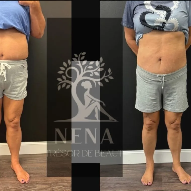 141B2D52-DAD1-4181-B6DC-1381250BE08B